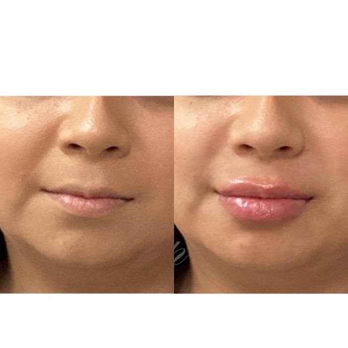 Images Santa Monica Medical Aesthetics