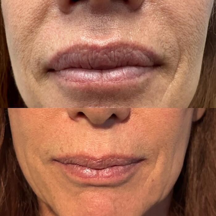 Images Santa Monica Medical Aesthetics