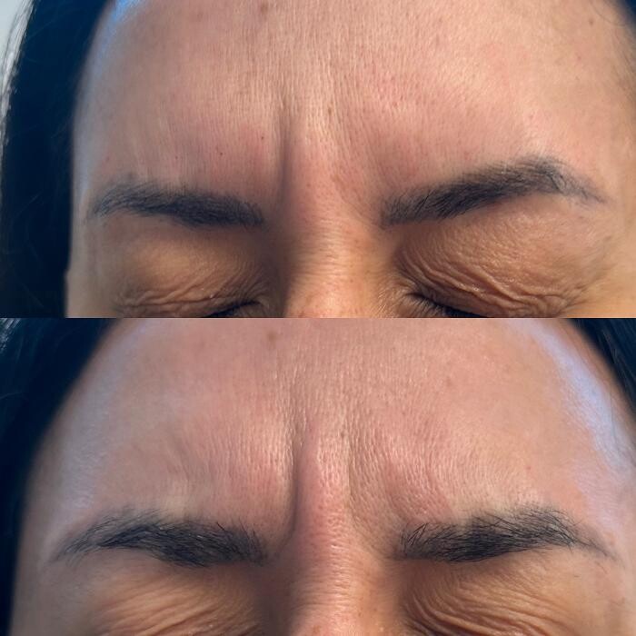 Images Santa Monica Medical Aesthetics