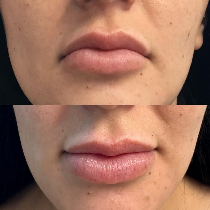 Images Santa Monica Medical Aesthetics