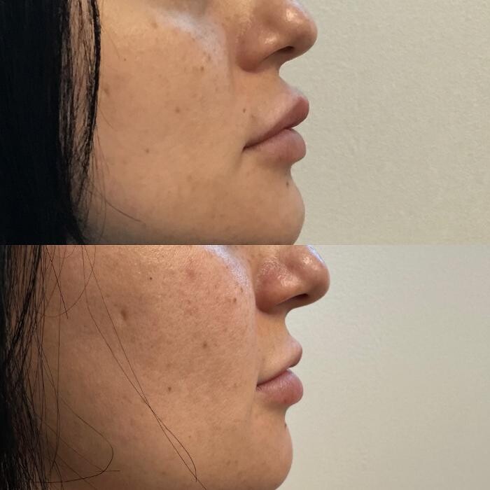 Images Santa Monica Medical Aesthetics