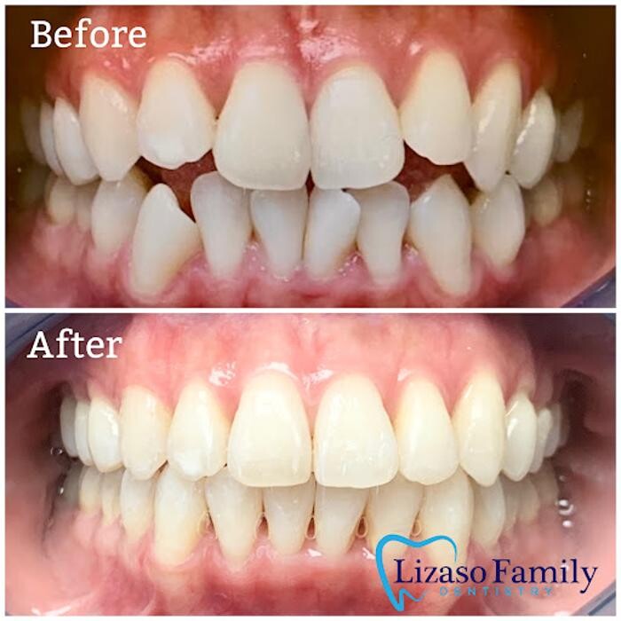 Images Lizaso Family Dentistry