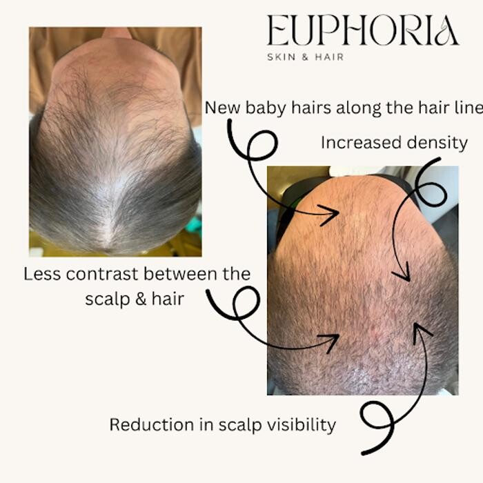 Images Euphoria Skin & Hair