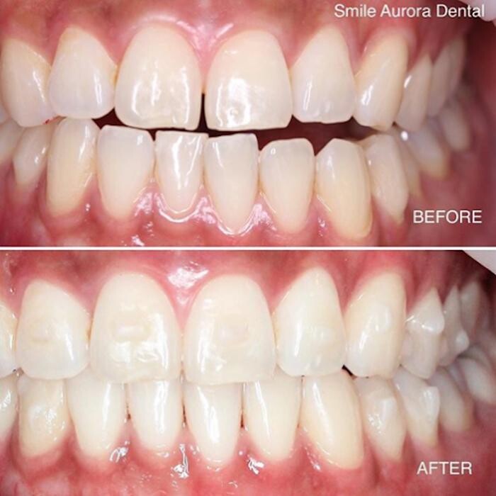 Images Smile Aurora Dental