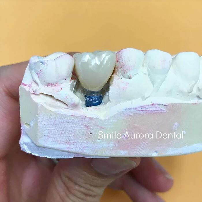 Images Smile Aurora Dental