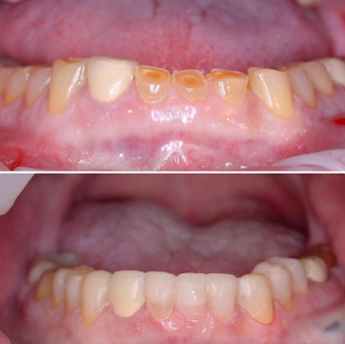 Images Smile Aurora Dental