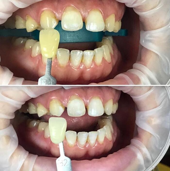 Images Smile Aurora Dental