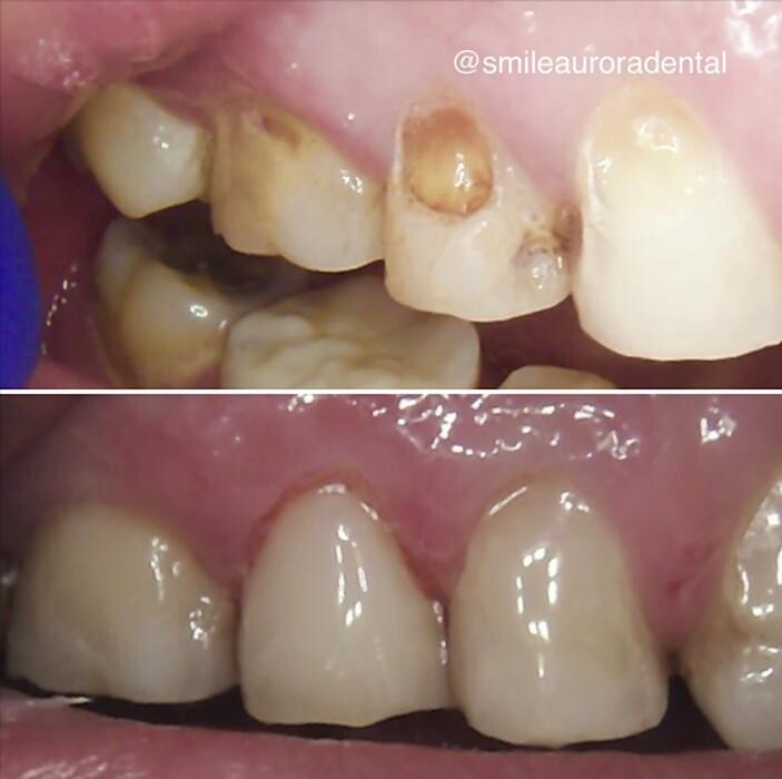 Images Smile Aurora Dental