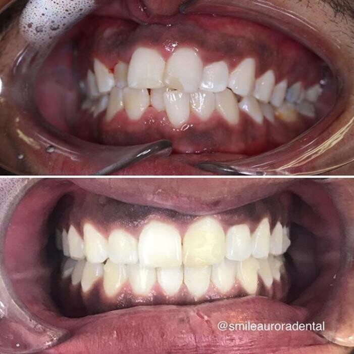 Images Smile Aurora Dental