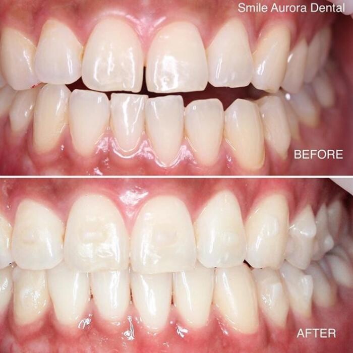 Images Smile Aurora Dental