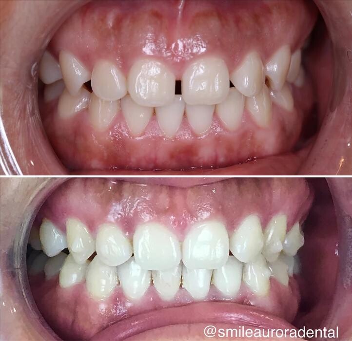 Images Smile Aurora Dental
