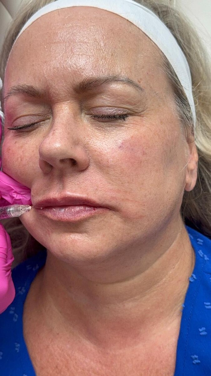 Images New You Wellness & Esthetics