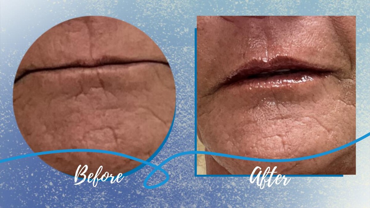 Images New You Wellness & Esthetics