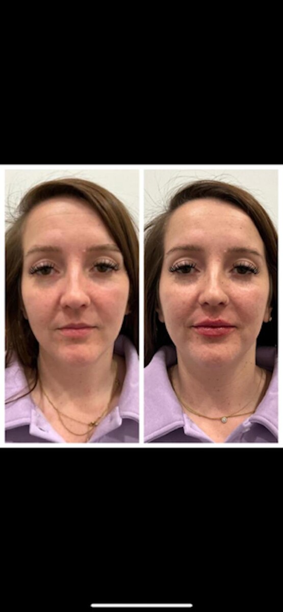 Images New You Wellness & Esthetics