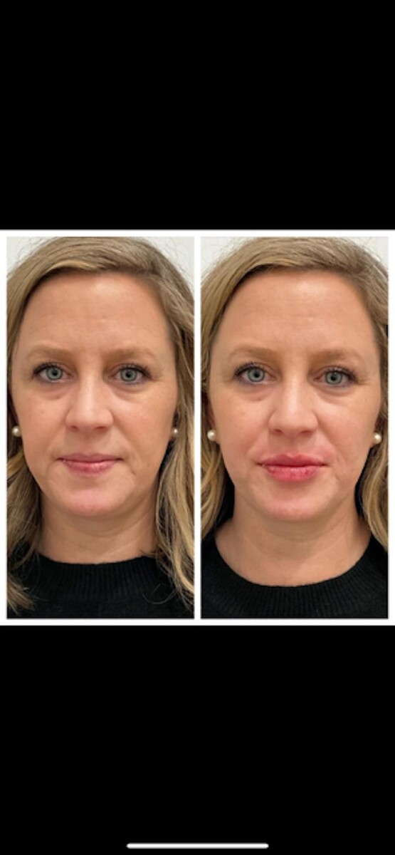 Images New You Wellness & Esthetics