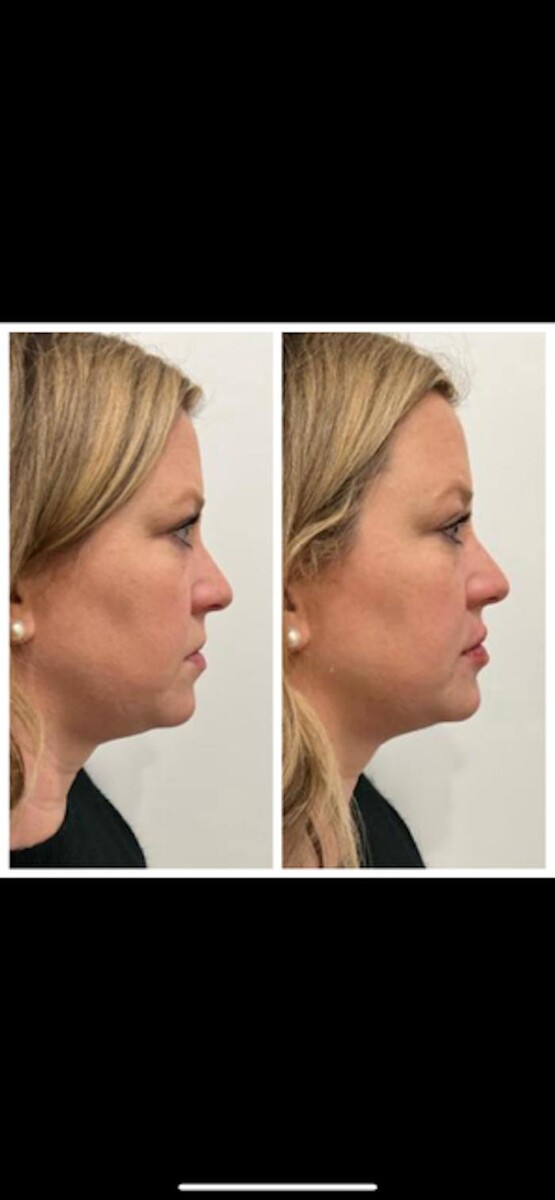 Images New You Wellness & Esthetics