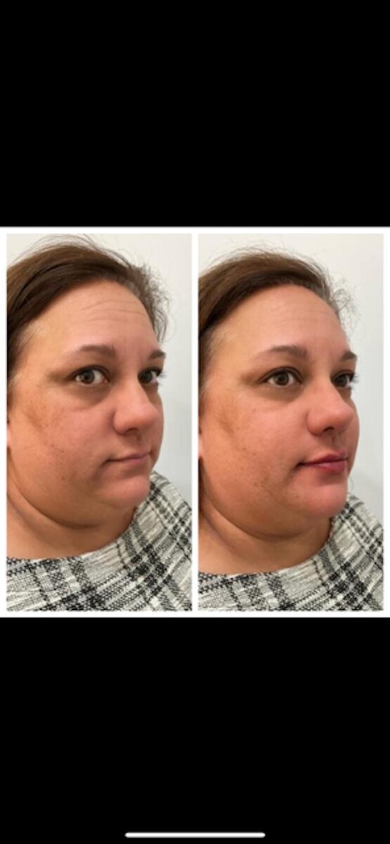 Images New You Wellness & Esthetics