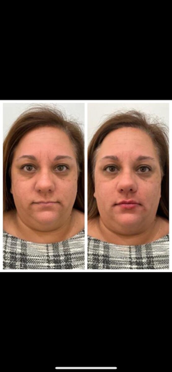 Images New You Wellness & Esthetics