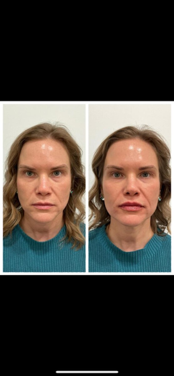Images New You Wellness & Esthetics