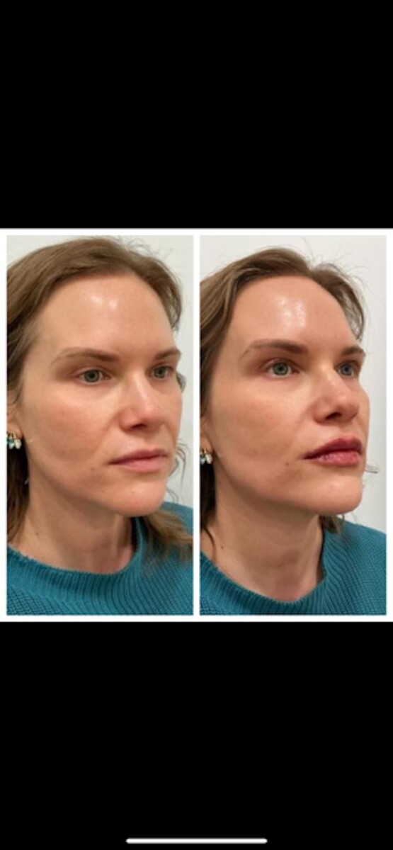 Images New You Wellness & Esthetics