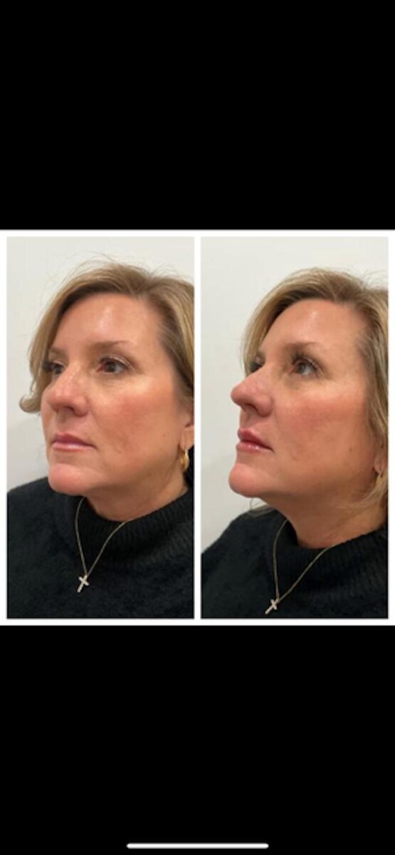 Images New You Wellness & Esthetics