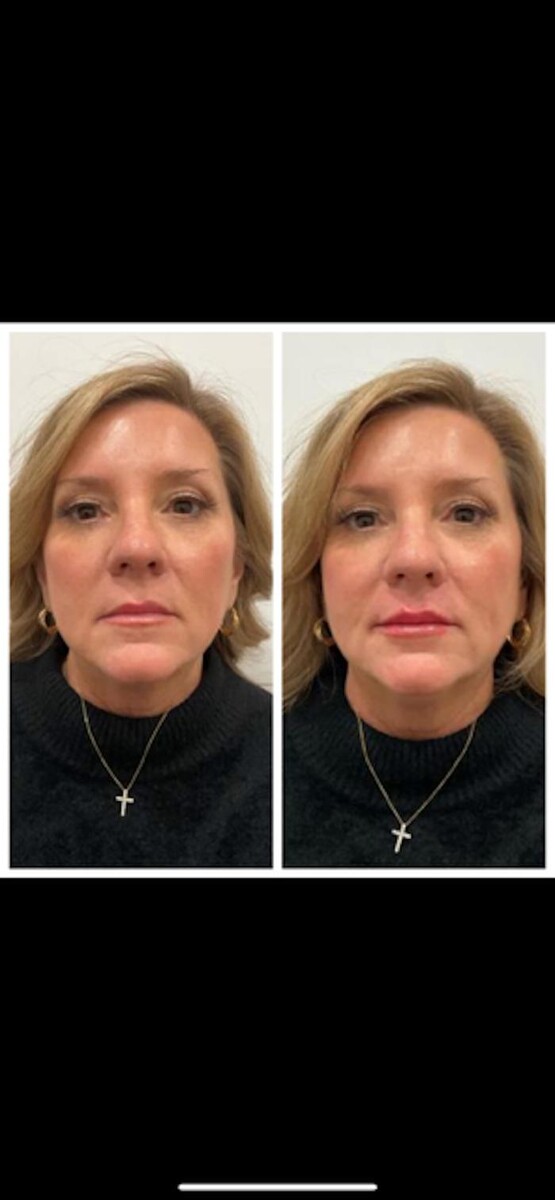Images New You Wellness & Esthetics