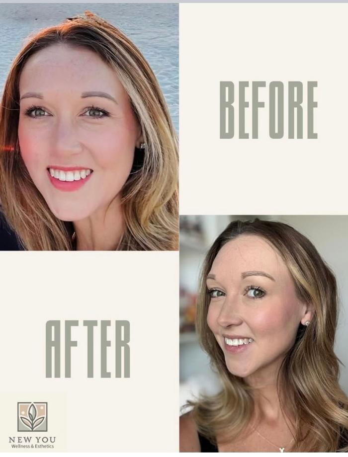 Images New You Wellness & Esthetics