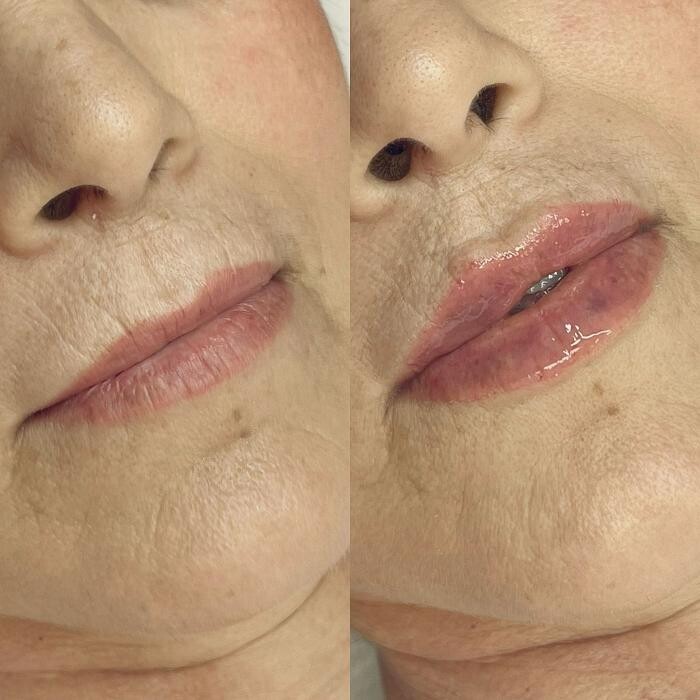 Images GlamGrin Medical Spa