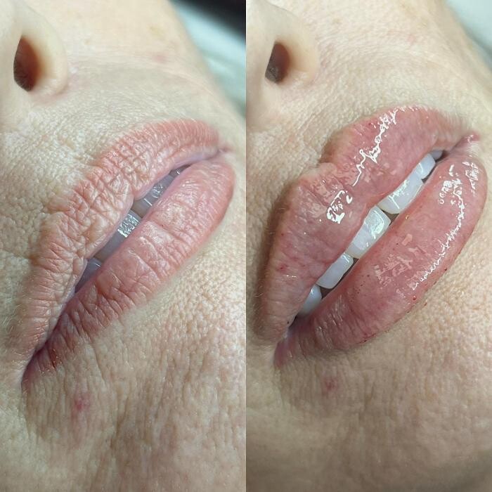 Images GlamGrin Medical Spa