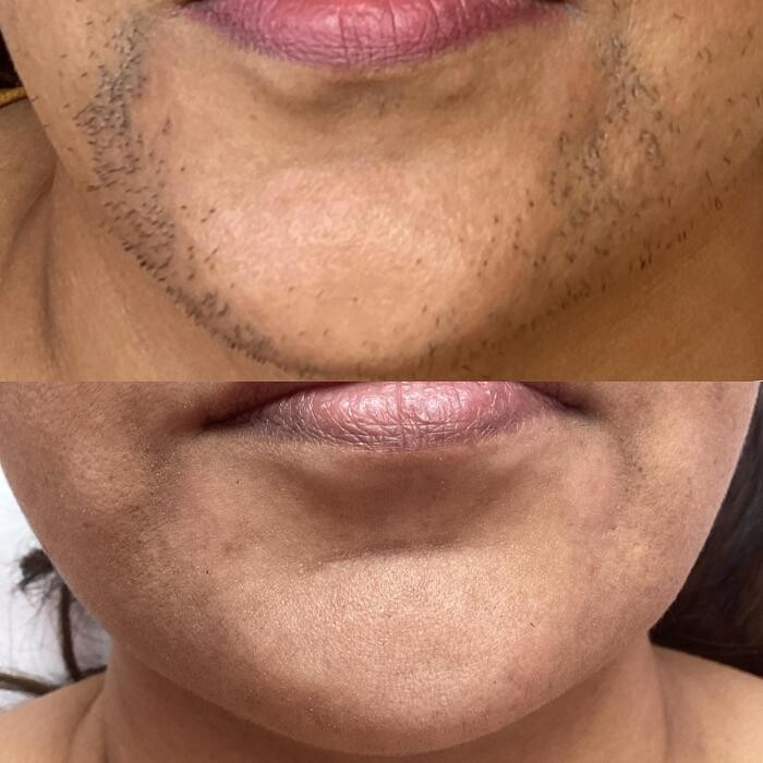 Images GlamGrin Medical Spa