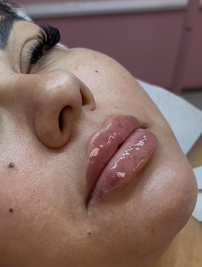 Images GlamGrin Medical Spa