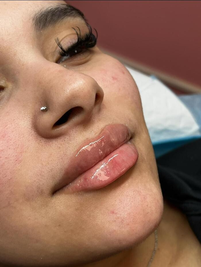 Images GlamGrin Medical Spa