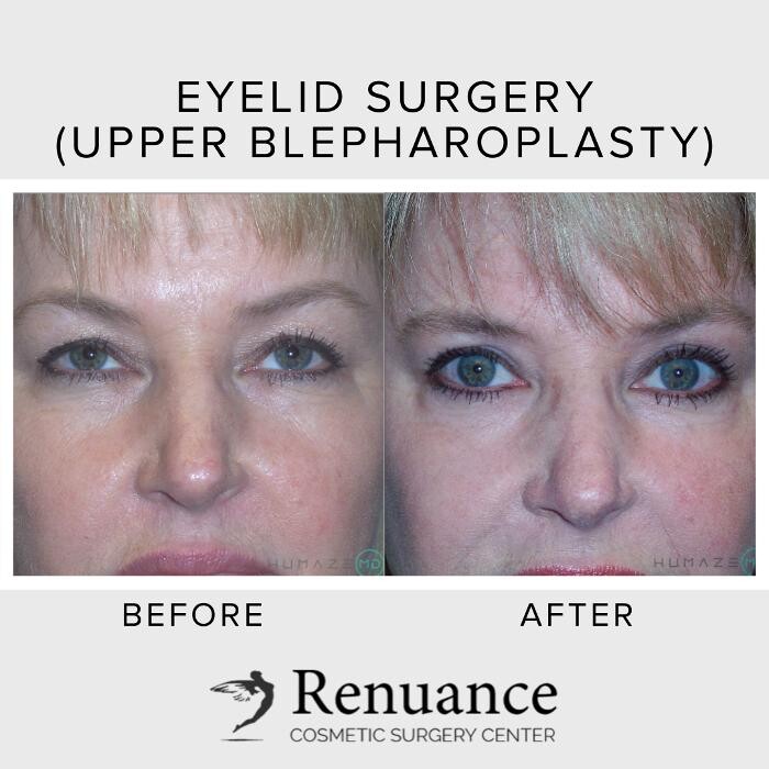 Images Renuance Cosmetic Surgery and MedSpa