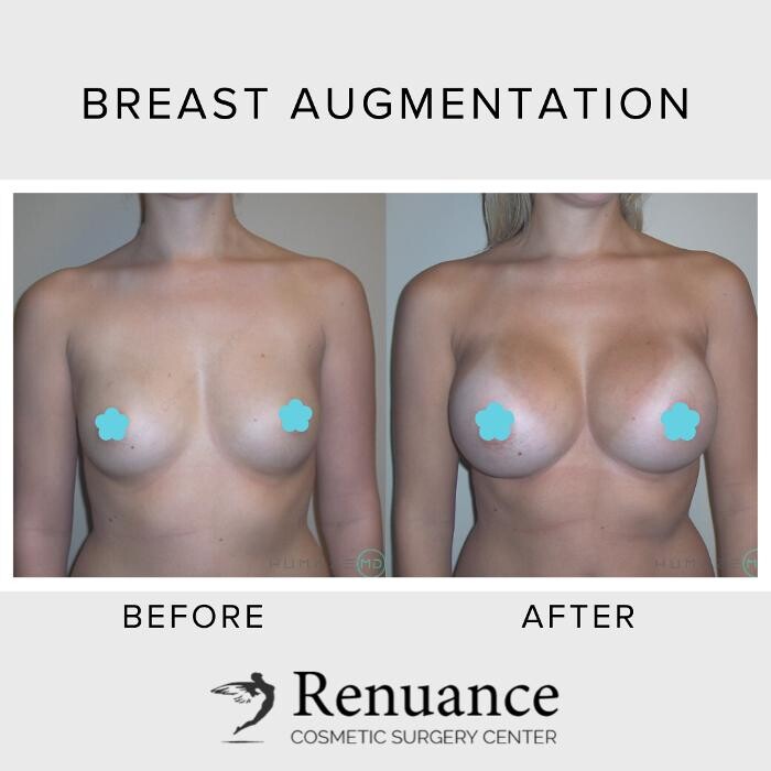 Images Renuance Cosmetic Surgery and MedSpa
