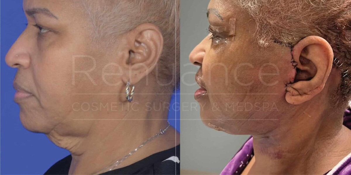 Images Renuance Cosmetic Surgery and MedSpa