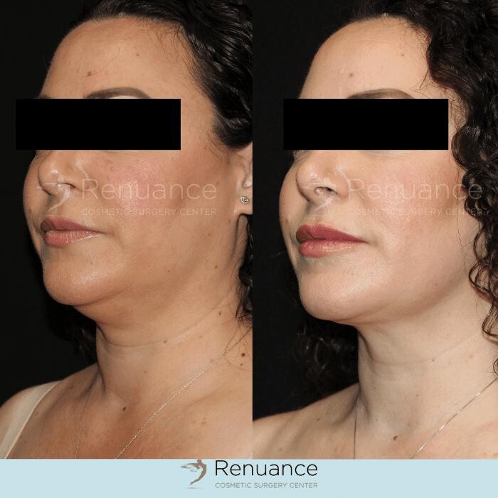 Images Renuance Cosmetic Surgery and MedSpa