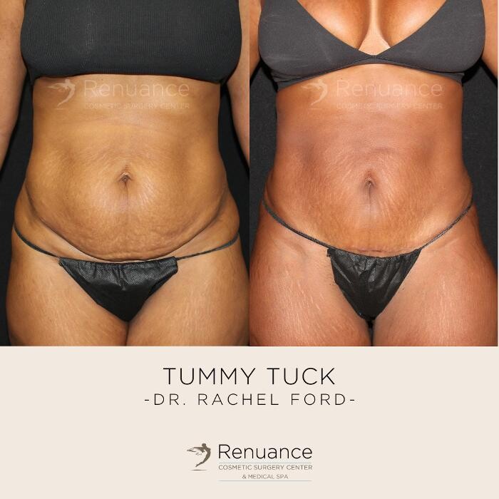 Images Renuance Cosmetic Surgery and MedSpa