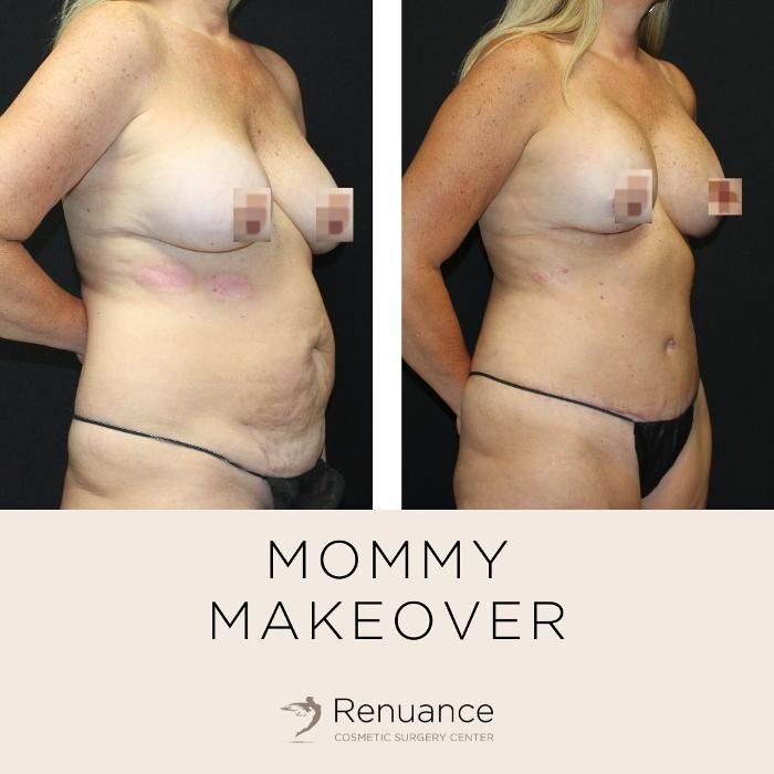 Images Renuance Cosmetic Surgery and MedSpa