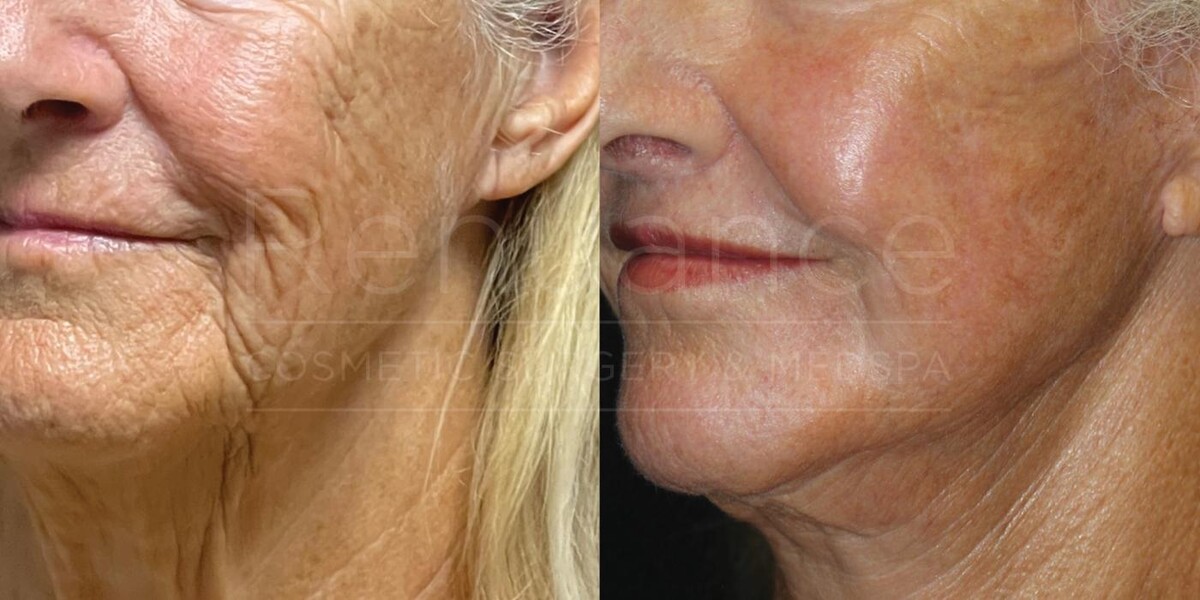 Images Renuance Cosmetic Surgery and MedSpa