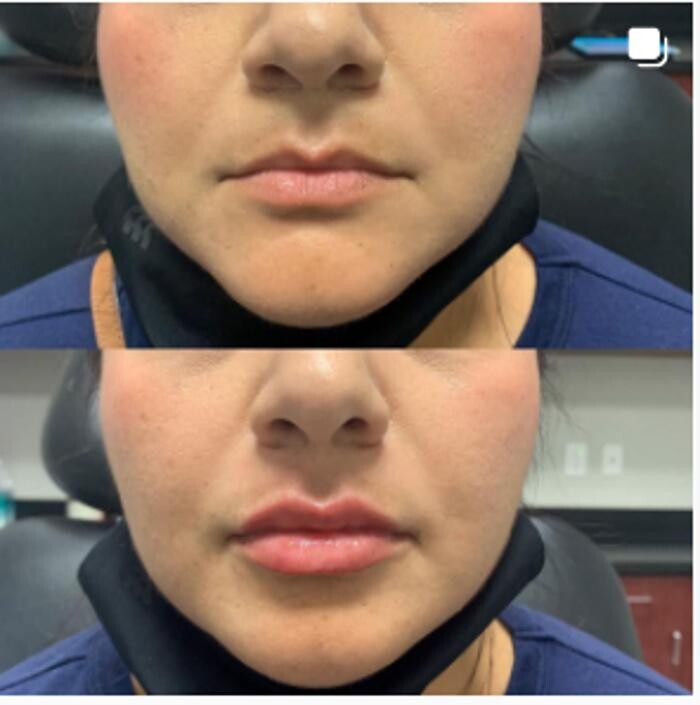 Images Renuance Cosmetic Surgery and MedSpa