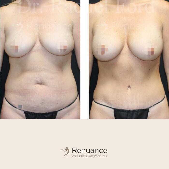 Images Renuance Cosmetic Surgery and MedSpa