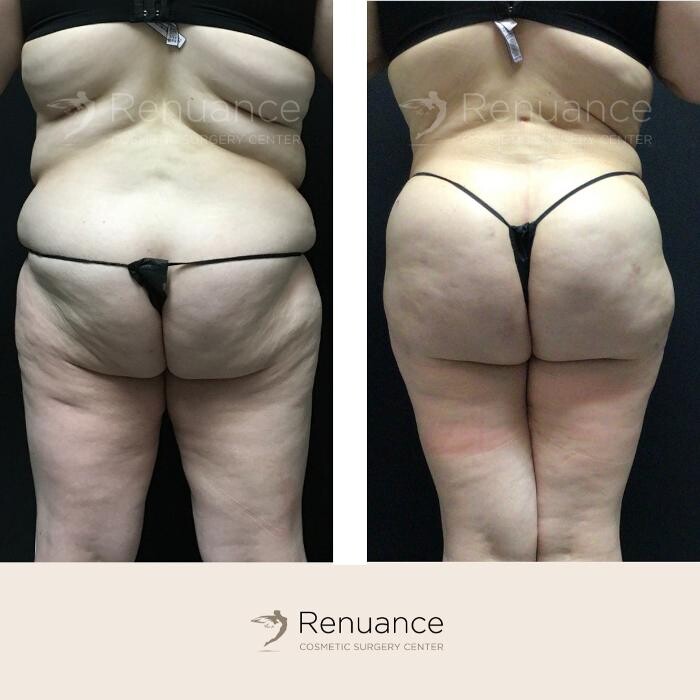 Images Renuance Cosmetic Surgery and MedSpa