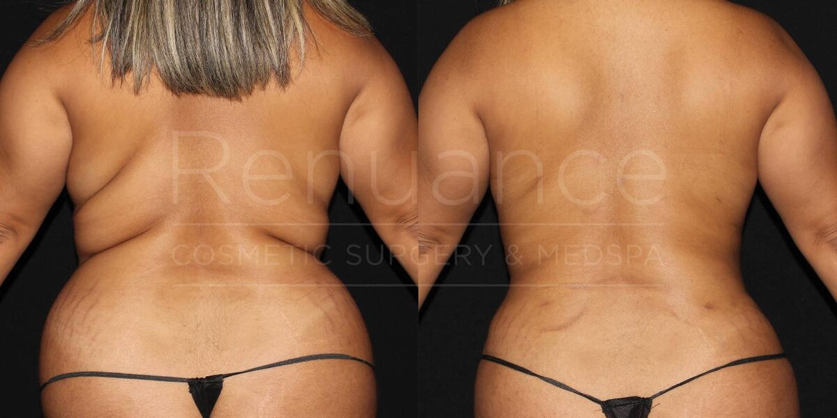 Images Renuance Cosmetic Surgery and MedSpa