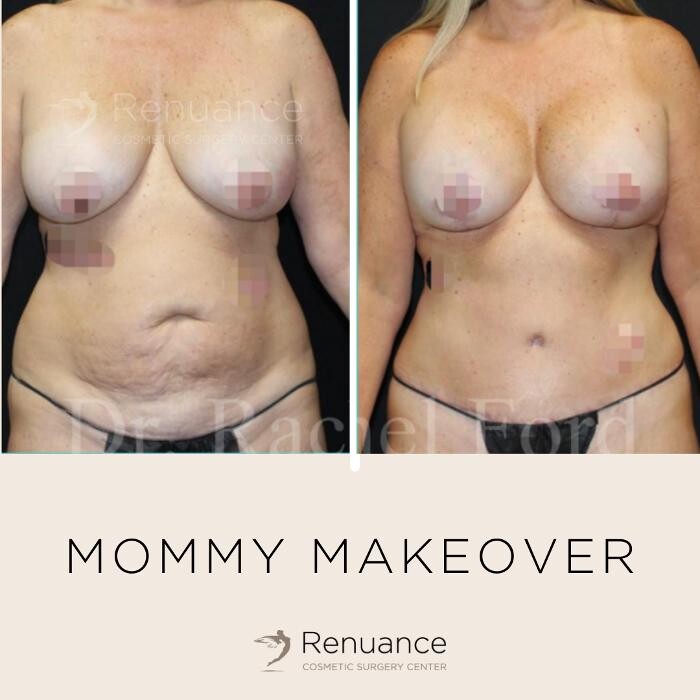 Images Renuance Cosmetic Surgery and MedSpa