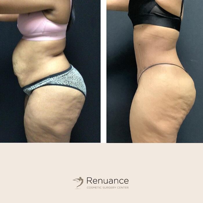 Images Renuance Cosmetic Surgery and MedSpa