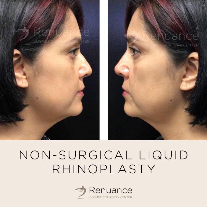 Images Renuance Cosmetic Surgery and MedSpa