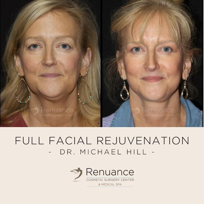 Images Renuance Cosmetic Surgery and MedSpa