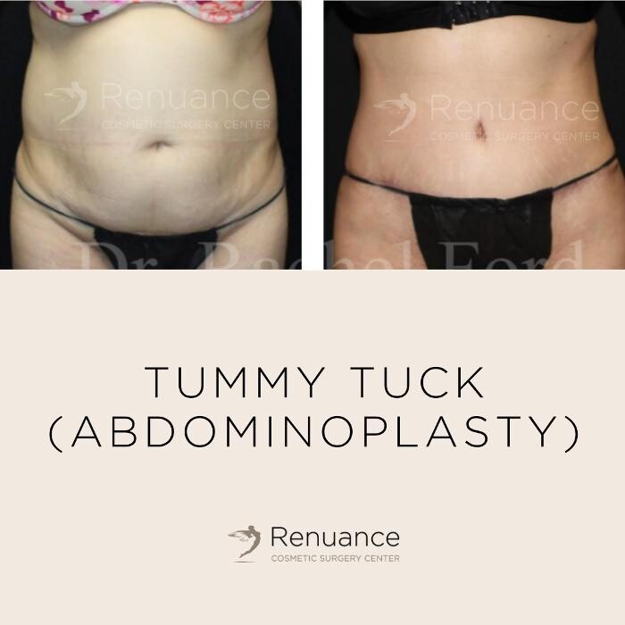 Images Renuance Cosmetic Surgery and MedSpa