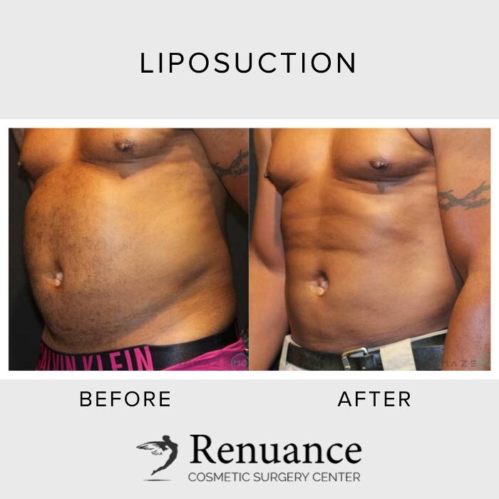 Images Renuance Cosmetic Surgery and MedSpa