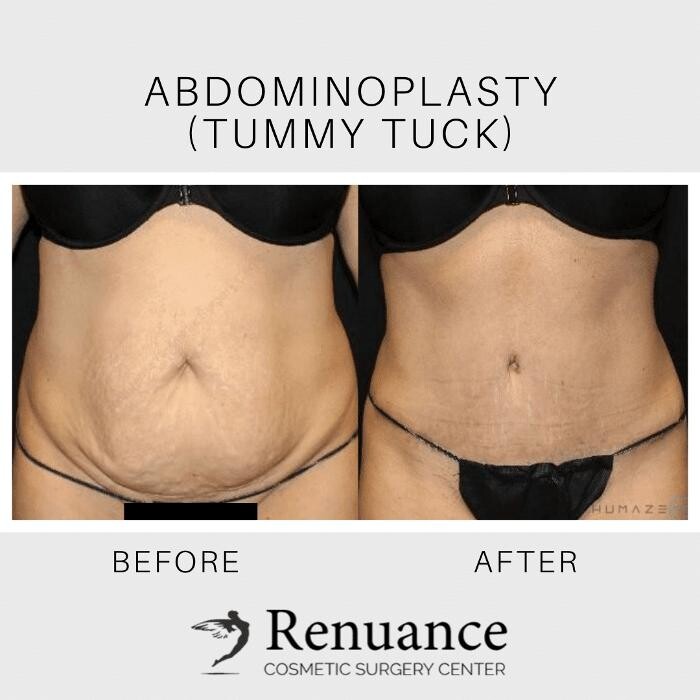 Images Renuance Cosmetic Surgery and MedSpa